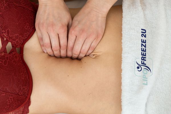 diastasis recti treatment Dagenham