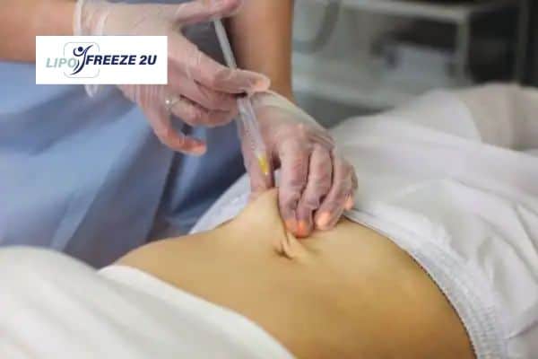How Does Aqualyx Fat Dissolving Injection Work to Break Down Fat Dagenham?