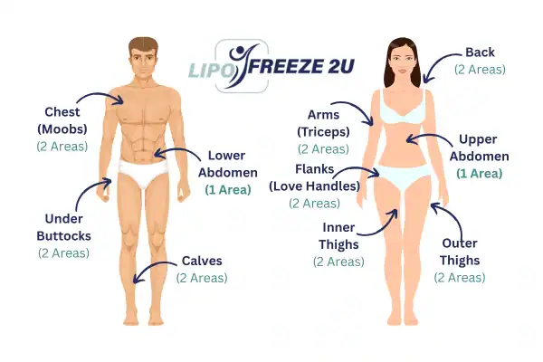 Areas you can have fat freezing treatment Dagenham