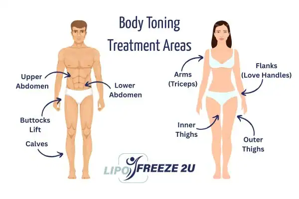 Graphic showing where you can have Body toning Treatment Dagenham on your body