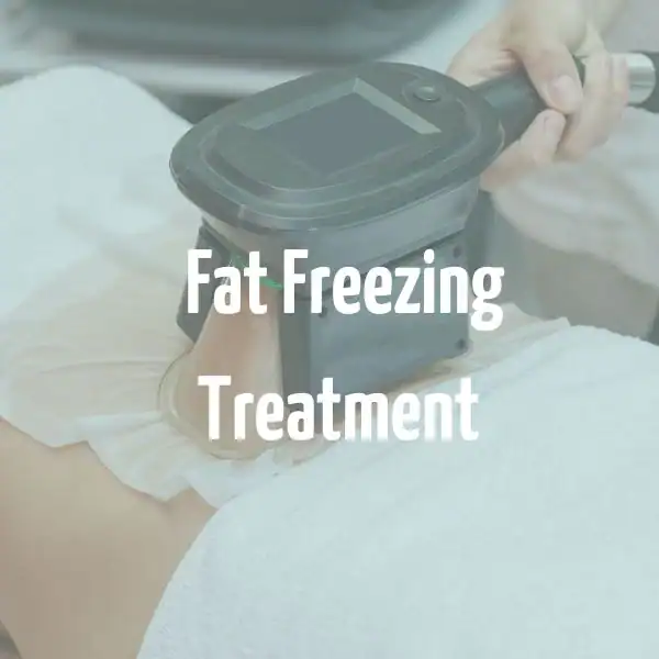fat freezing treatment Dagenham