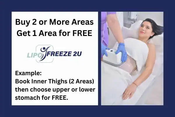 fat freezing prices Dagenham