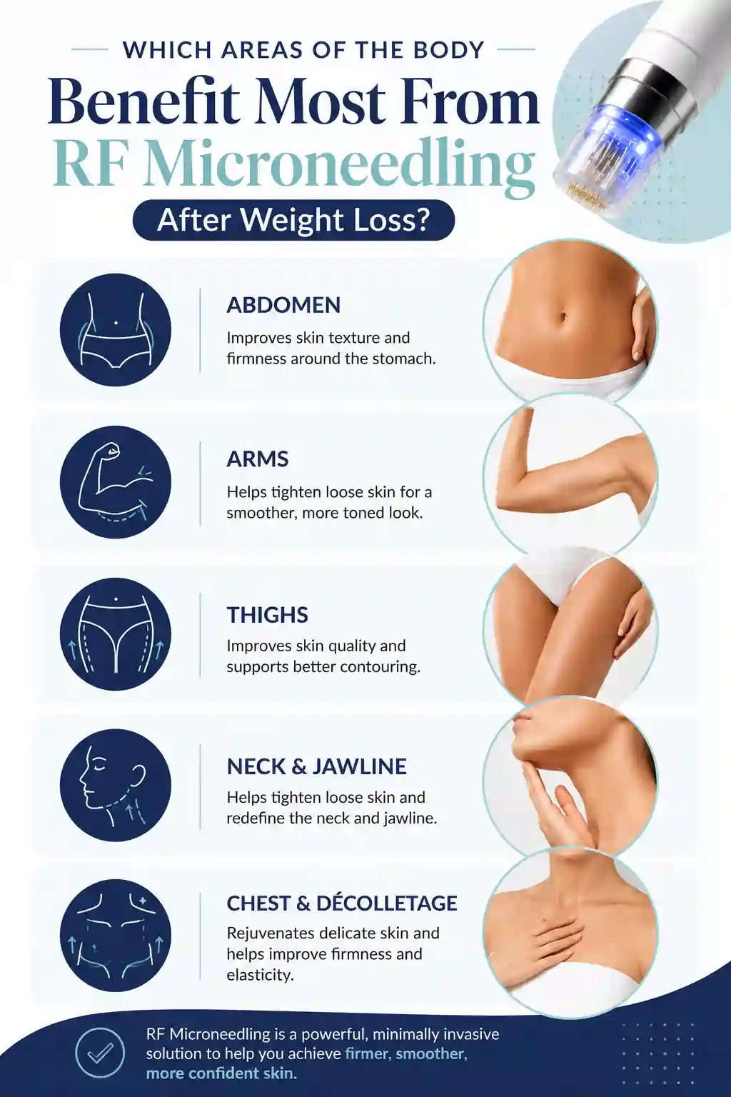 Which Areas of the Body Benefit Most From RF Microneedling After Weight Loss Dagenham